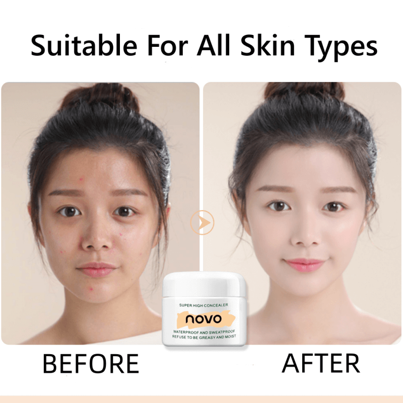 Dark Spot Remover Skin Lightening Cream  Face Care Concealer