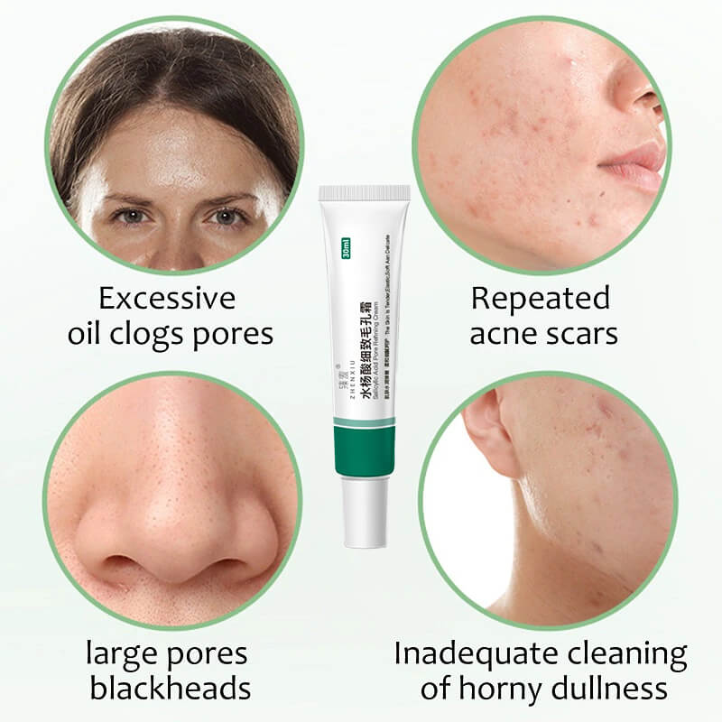 Salicylic Acid Cream  Oil Control Anti-Acne Face Cream