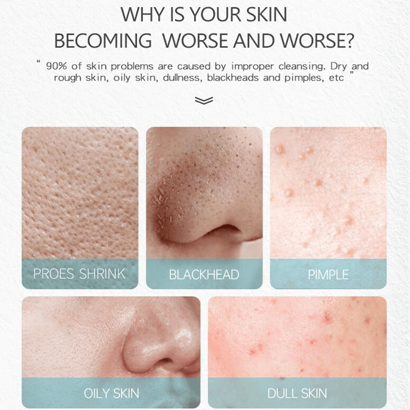 Salicylic Acid Cream  Oil Control Anti-Acne Face Cream